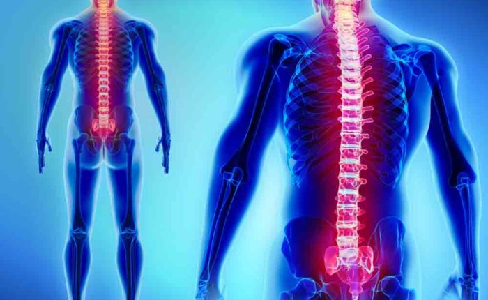 spinal cord injury rehabilitation, spinal cord injury rehabilitation near me, rehabilitation goals for spinal cord injury